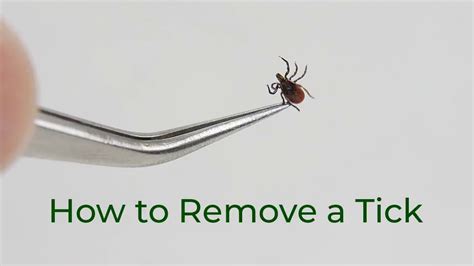 Safe Tick Removal Youtube