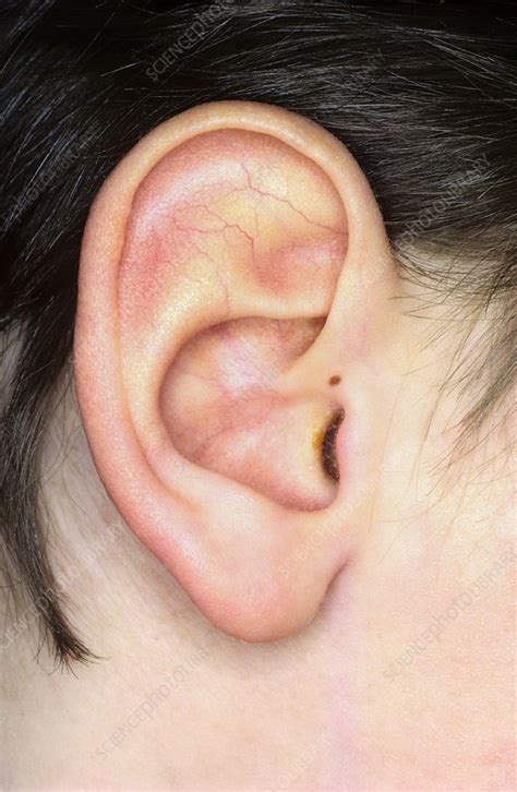 Young Boys Ear Stock Image C0146942 Science Photo Library