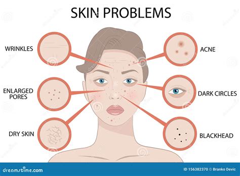 Skin Problems Icons Cartoon Vector 74671641