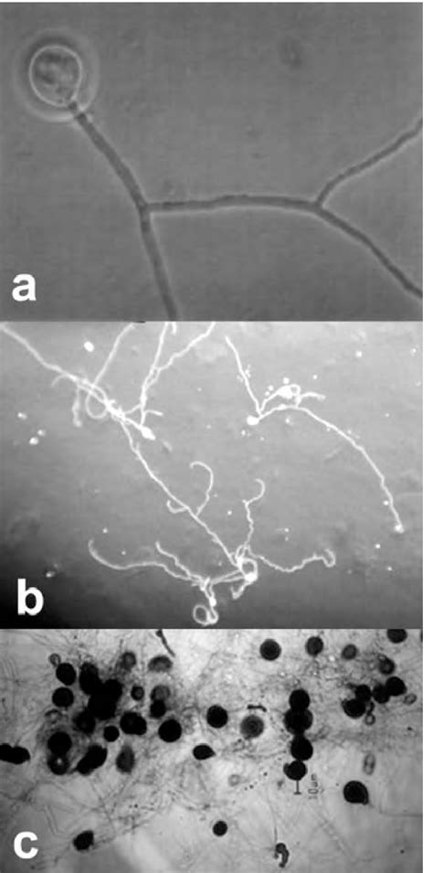 Chlamydospores Of P Indica A Germinating Chlamydospore Showing