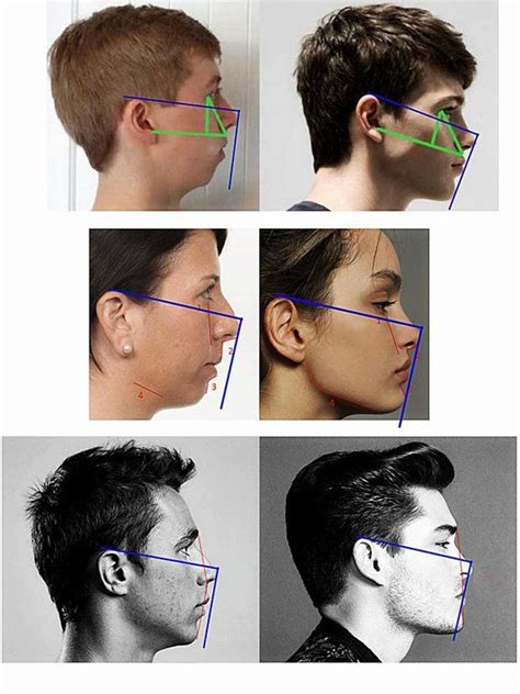 A Good Way To Measure Forward Facial Growth The Blue Lines Sorry