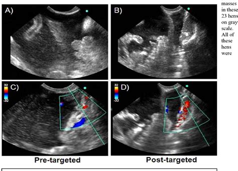 Figure 1 From Arly Detection Of Ovarian Cancer By Tumor Epithelium Targeted Molecular Ultrasound