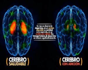 C Mo Afectan Las Drogas En El Cerebro Centro De Desintoxicaci N