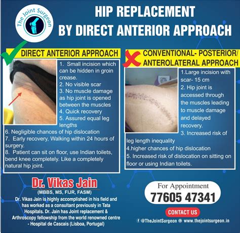 Hip Replacement By Direct Anterior Approach In Indore Madhya Pradesh