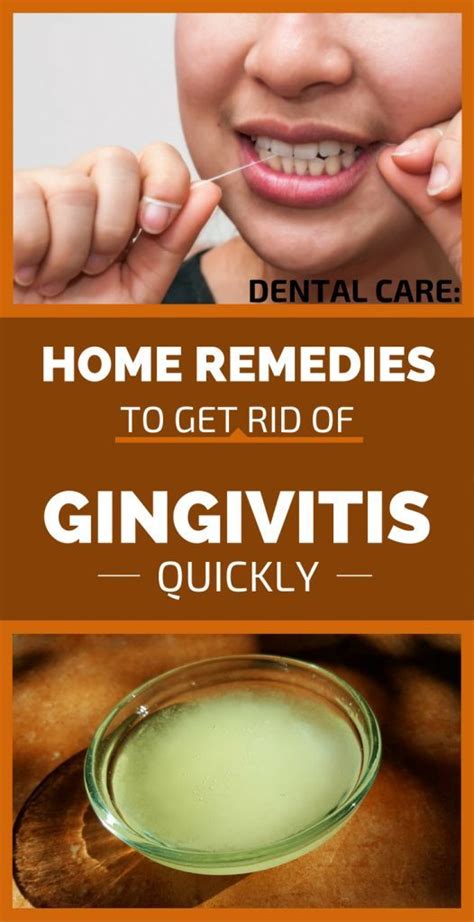 10 Ways To Get Rid Of Swollen Gums Gum Disease Remedies Gingivitis