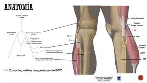 Figure 3 From ESTUDIO POR IMAGEN DE LA NEUROPATIA DEL NERVIO PERONEO