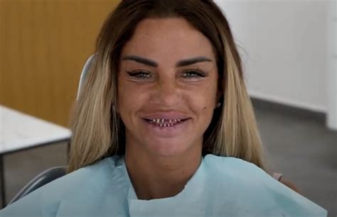 Katie Price Spits Out Her Fake Teeth After They Fall Off Her ‘bond