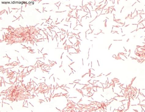 Legionella Pneumophila From Sputum Culture Gram Negative Bacilli