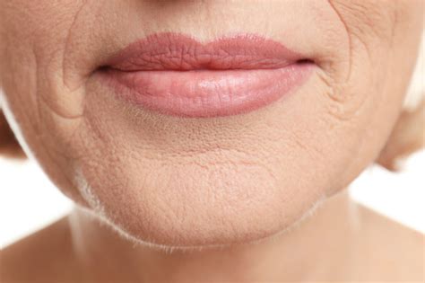 How To Get Rid Of Wrinkles Around Mouth Edges What Care The Causes