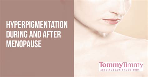 Skin Discoloration During And After Menopause