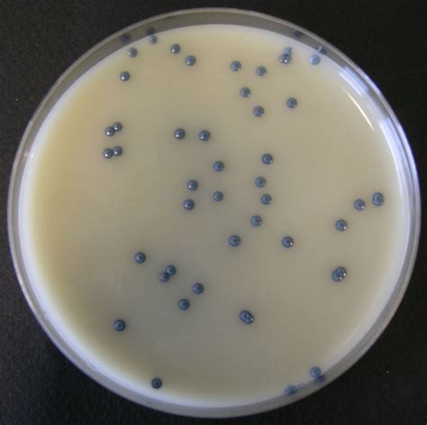 Es bestehen hinweise auf eine wirksamkeit gegen multiresistente keime wie mrsa und pseudomonas. CVUA Karlsruhe | MRSA