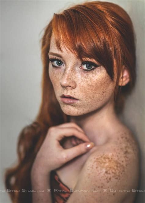 Redheadsmyonlyweakness Beautiful Freckles Freckles Girl Redheads