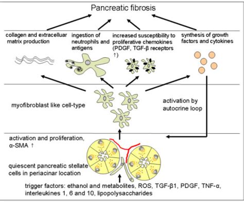Chronic Pancreatitis Pathophysiology Wikidoc
