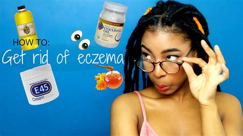 How To Get Rid Of Eczema Youtube