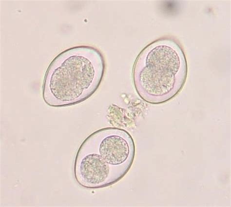 We prefer that if you post photos, it be of your own cat(s) or one(s) you this time they found coccidia in his feces. How do Dogs Get Coccidia? | HubPages