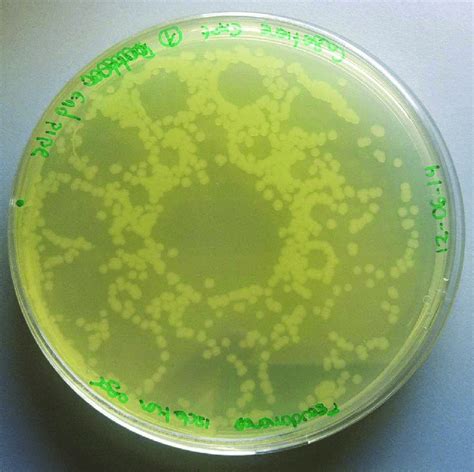 Pattern And Number Of Viable Pseudomonas Putida Kt2440 At The End Of