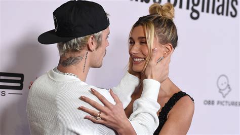 Justin Bieber Leans On Faith In Christ During Ongoing Bout With Facial