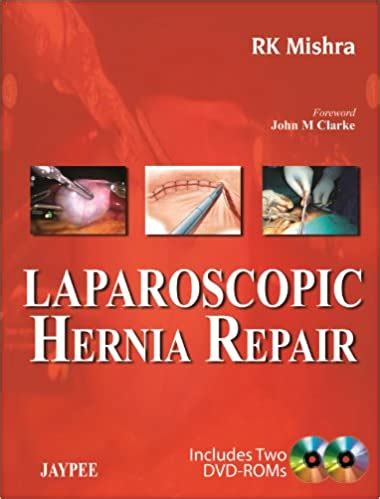 Laparoscopic Hernia Repair St Edition Pdf