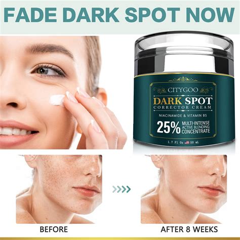 Buy Citygoo Dark Spot Remover For Face And Body Dark Spot Corrector