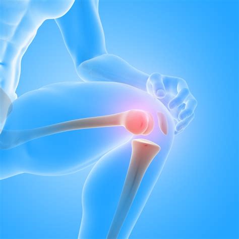Jun 10, 2021 · liputan6.com, jakarta penyebab sakit lutut adalah cedera sampai masalah kesehatan yang berkaitan dengan tulang, sendi, ligamen, dan tendon. 8 Penyebab Lutut Sakit dan Nyeri, Kenali Gejala dan Cara ...