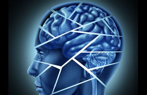 Poststroke Neurocognitive Disorder Prevalent In Acute Stroke