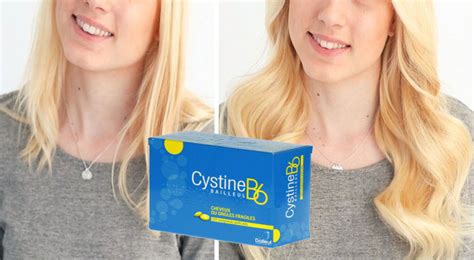 Vitamine Cystine B6 Chute De Cheveux Avis Test Description Prix