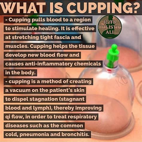 Cupping Therapy‼️ 🕵️📖🕵️ Did You Know⁉️ Follow 👣ejmfittips For Daily Fit Tips And Motivation 📷