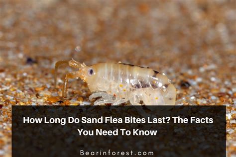 How Long Do Sand Flea Bites Last The Facts You Need To Know Bearinforest