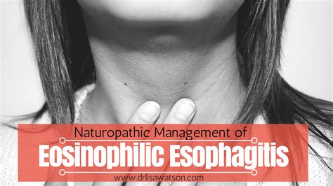 Naturopathic Treatment Of Eosinophilic Esophagitis Dr Lisa Watson