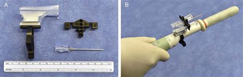 Initial Experience Performing In Office Ultrasound Guided Transperineal