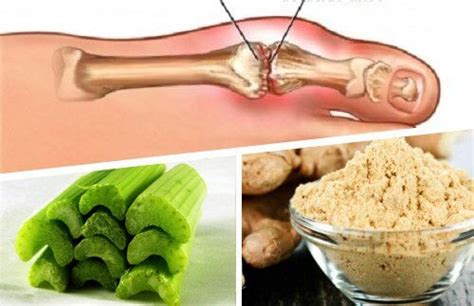 Eliminate Uric Acid Crystals With Ginger And Celery Step To Health