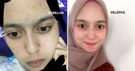 Petua ni merupakan tips utama untuk dapatkan kulit muka yang lembap, sihat dan glowing. Inilah Tips Yang Betul Tonyoh Tomato Kat Muka Supaya ...
