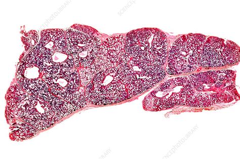 Breast In Pregnancy Light Micrograph Stock Image C