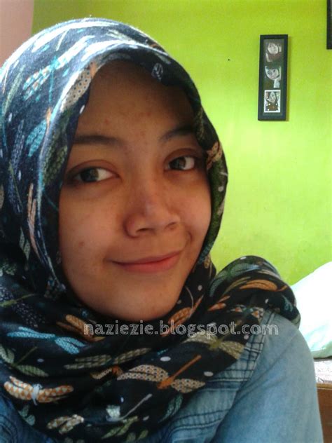 Review Propolis Melia Sehat Sejahtera | Mengatasi jerawat dengan cepat