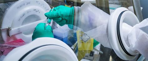 La variante del coronavirus lamba, primero detectada en perú y llamada andina, podría llegar a ser de preocupación mundial, según la organización mundial de la salud (oms). Spunta la variante Lambda, individuata in Perù. L'Oms: una ...