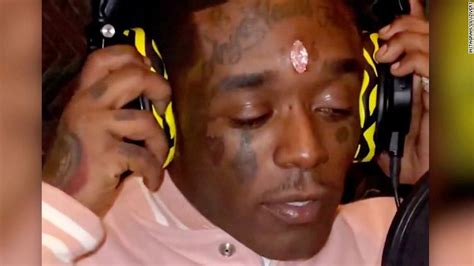 Rapper Lil Uzi Vert Got A 24m Diamond Embedded In His Forehead Cnn Video