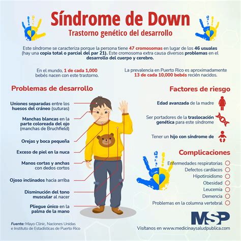 Síndrome De Down Infografía