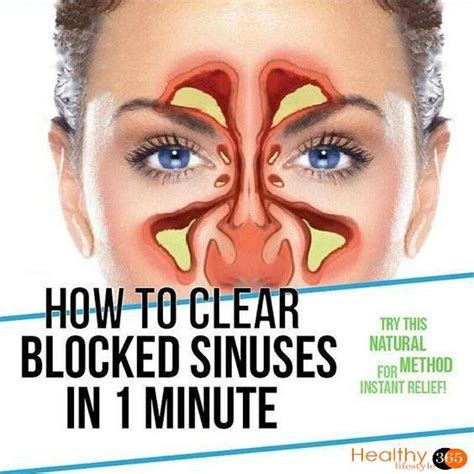How To Clear Seriously Blocked Sinuses Naturally In 1 Minute Video