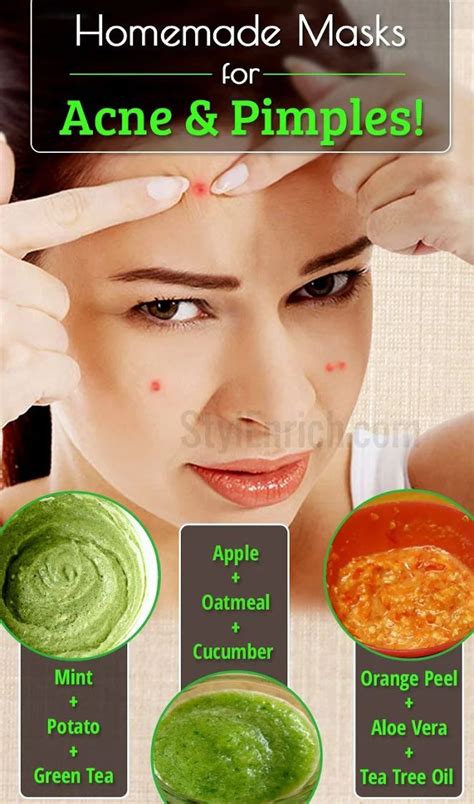 Home Remedies For Pimples 3 Homemade Masks To Treat Acne Hausmittel