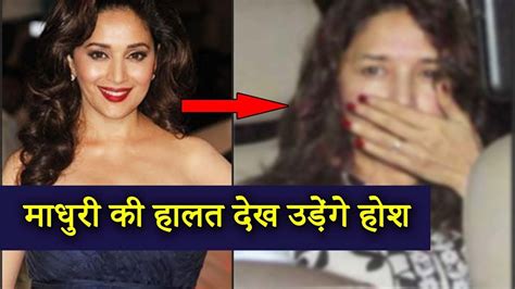 कैसे हुई माधुरी दीक्षित की ये हालत Madhuri Dixit Without Makeup Pics