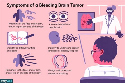 Brain Tumors And The Risk Of Stroke