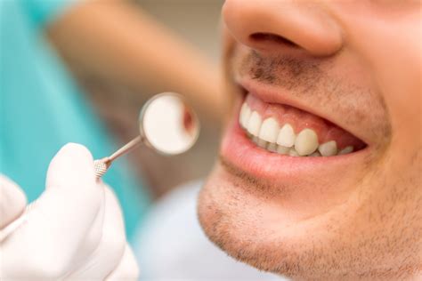 Evaluación Limpieza Dental Destartraje Supragingival 67 Dto