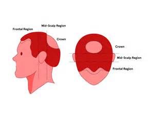 Regions Of The Head