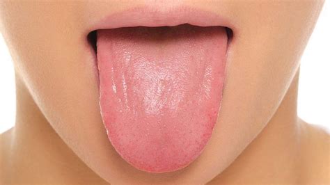 what your tongue can tell you about your health