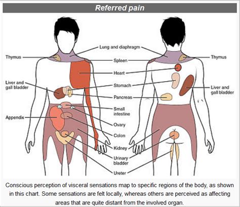 The Origins Of Musculoskeletal Pain Which Describes Yours The Pain