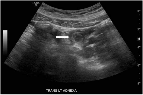 Complete Abdominal Ultrasound Using Real Time With Image Documentation