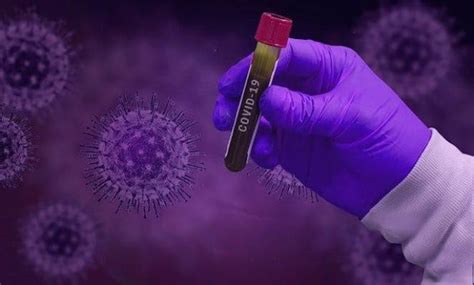 Cowin registration done , i can't move beyond that , not able to chose next step of selection for registration, users can upload any one of the officially recognised 12 identification documents. CoWin App for COVID-19 Vaccine Registration in India: Platform Not Opening for Public Anytime Soon