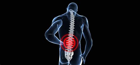 Lower back pain most common cause, symptoms, examination of back, medical and physiotherapist treatment, exercise, back care, ergonomic of back. Back Injury | Napolin Law Firm