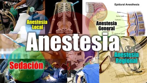 Tipos De Anestesia Sabias Cuantos Tipos De Anestesia Existen Youtube