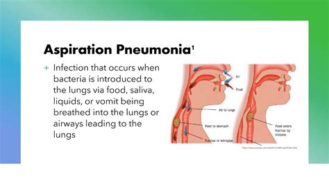 Aspiration Pneumonia Review Youtube